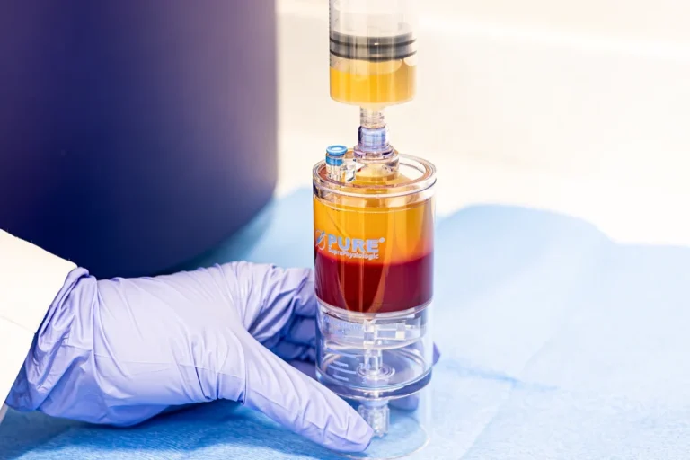 Medical centrifuge tube used in platelet rich plasma (PRP) therapy processing