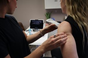 Patient undergoing shoulder ultrasound examination for rotator cuff evaluation.